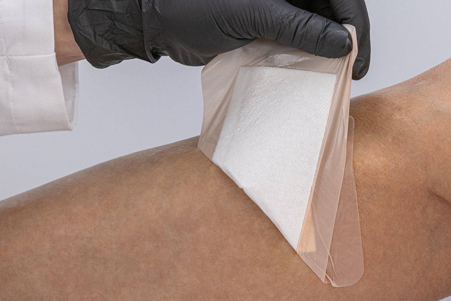 5 Best Advanced Wound Care Dressings That Speed Up Healing and Save Time