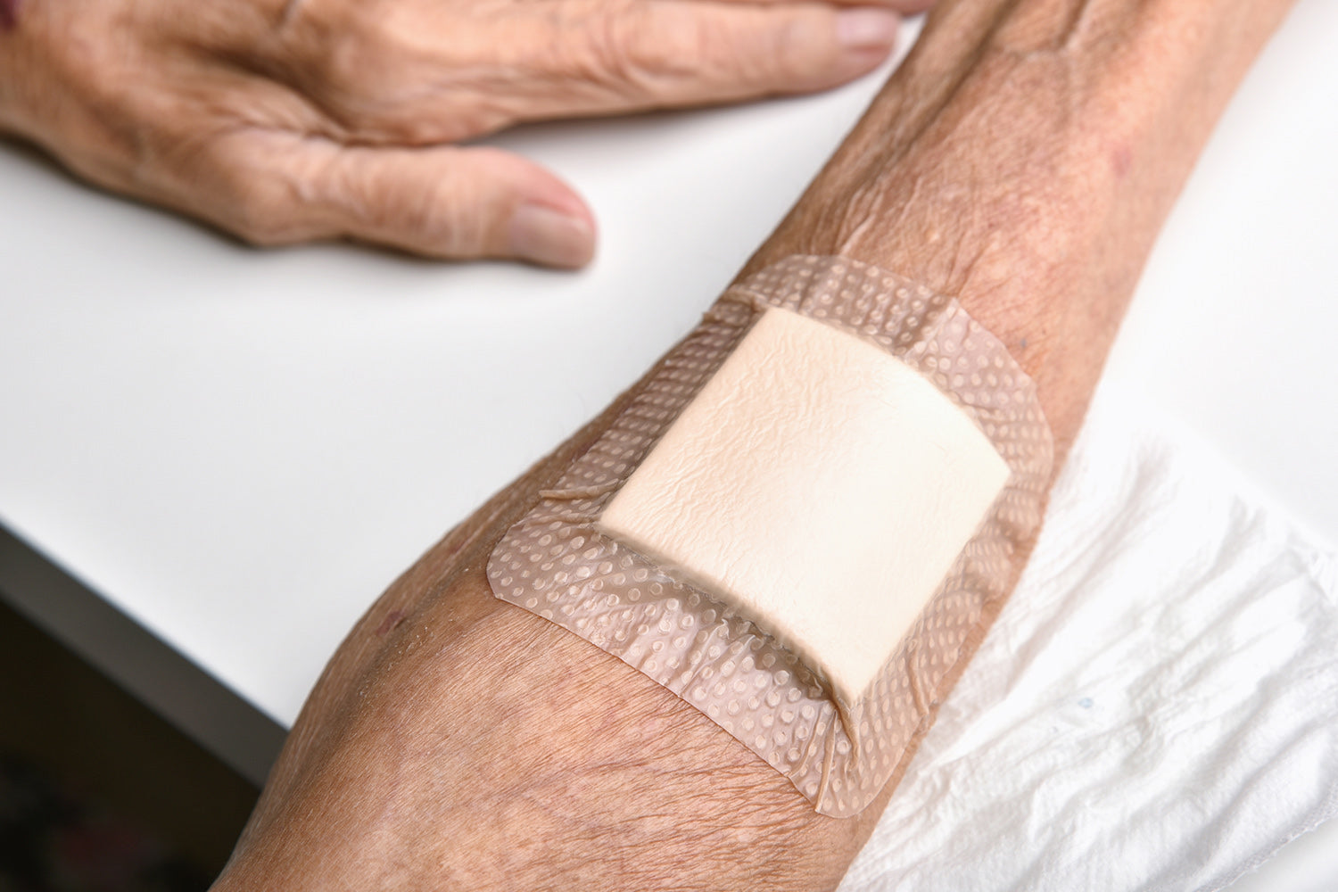 Wound Care Dressings: Types and Applications