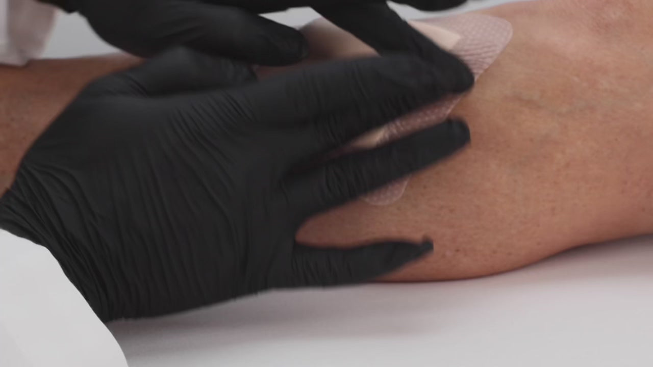 Load video: Vitale Silicone Foam Dressing product details